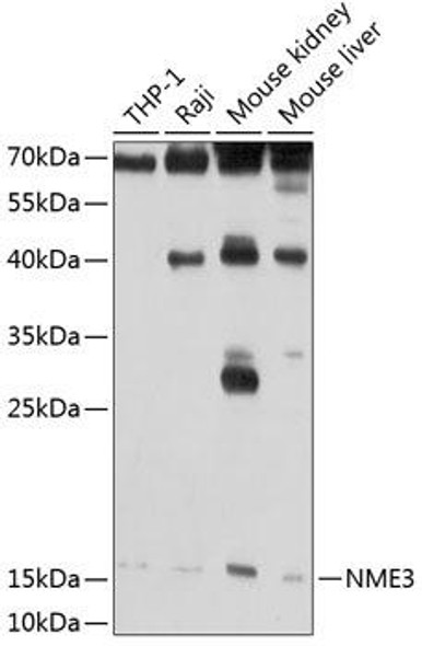 Cell Death Antibodies 1 Anti-NME3 Antibody CAB2774