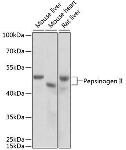Cell Biology Antibodies 8 Anti-Pepsinogen II Antibody CAB2788