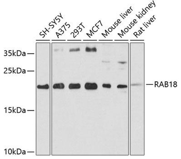 Cell Biology Antibodies 8 Anti-RAB18 Antibody CAB2812