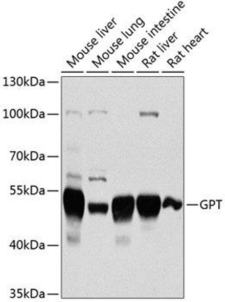 Cell Biology Antibodies 8 Anti-GPT Antibody CAB2814