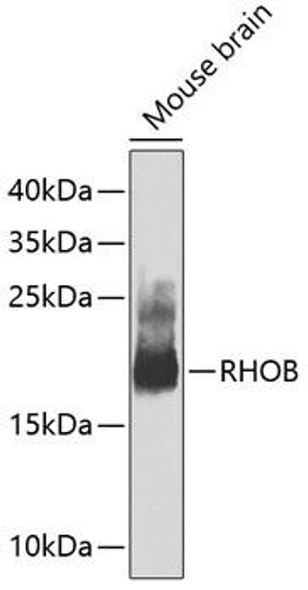 Cardiovascular Antibodies Anti-RHOB Antibody CAB2819