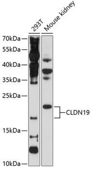 Signal Transduction Antibodies 2 Anti-CLDN19 Antibody CAB2874