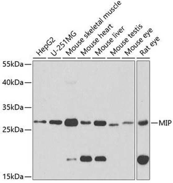 Signal Transduction Antibodies 2 Anti-MIP Antibody CAB2886