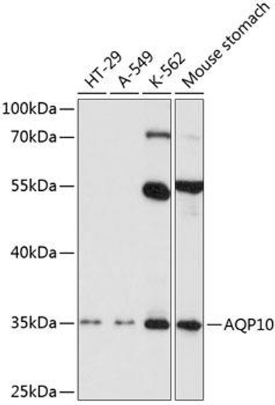 Signal Transduction Antibodies 2 Anti-AQP10 Antibody CAB2888