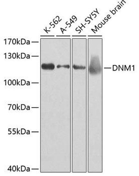 Cell Biology Antibodies 8 Anti-DNM1 Antibody CAB2902