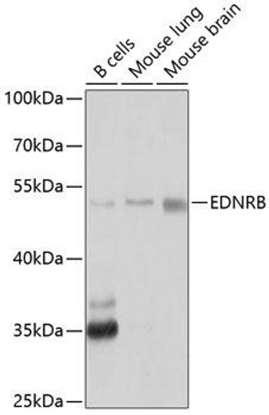 Cell Biology Antibodies 8 Anti-EDNRB Antibody CAB2908