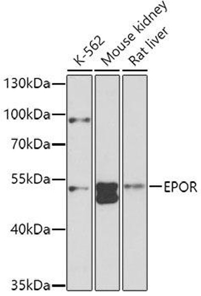 Cell Biology Antibodies 8 Anti-EPOR Antibody CAB2917