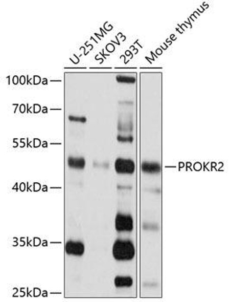 Cell Biology Antibodies 8 Anti-PROKR2 Antibody CAB2960