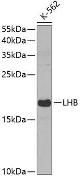 Cell Biology Antibodies 8 Anti-LHB Antibody CAB3000