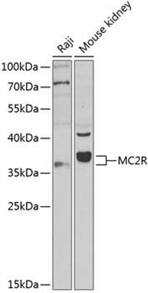 Cell Biology Antibodies 8 Anti-MC2R Antibody CAB3010