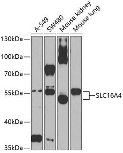 Signal Transduction Antibodies 2 Anti-SLC16A4 Antibody CAB3016