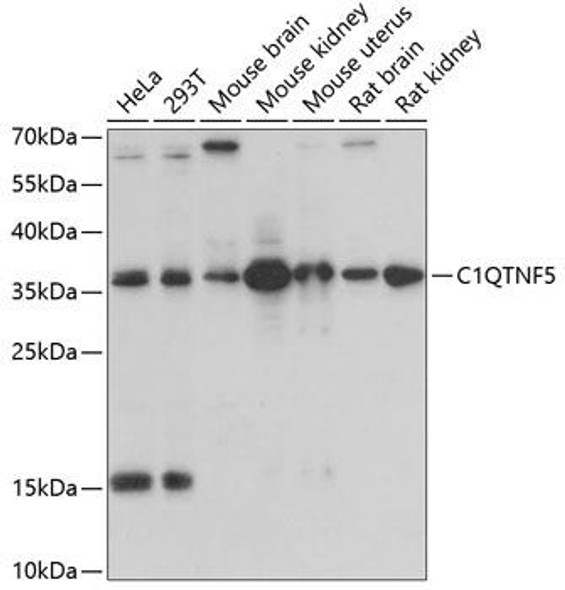 Cell Biology Antibodies 8 Anti-C1QTNF5 Antibody CAB3021