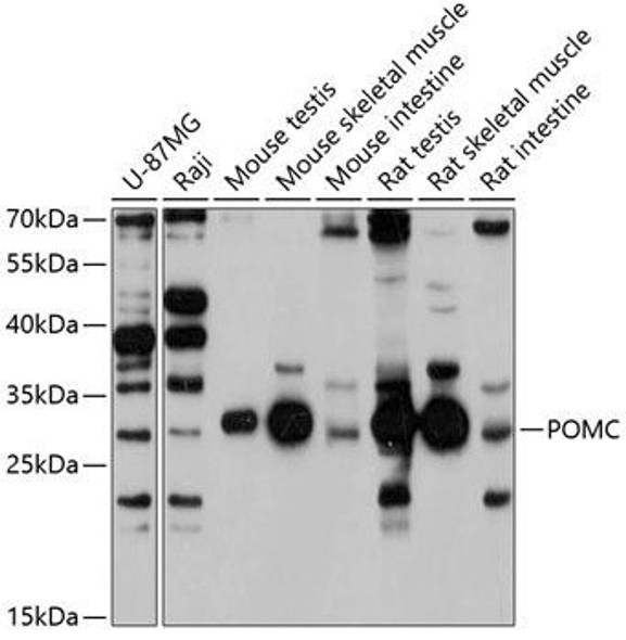 Cell Biology Antibodies 8 Anti-POMC Antibody CAB3038