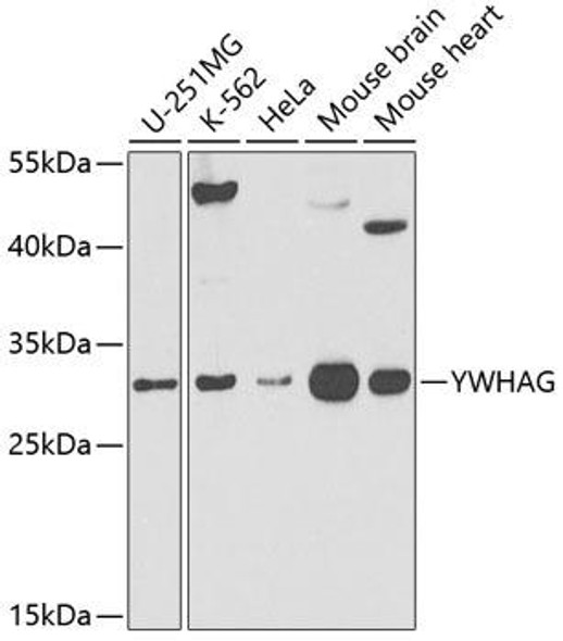 Cell Biology Antibodies 8 Anti-YWHAG Antibody CAB3043