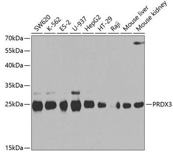 Cell Biology Antibodies 8 Anti-PRDX3 Antibody CAB3076
