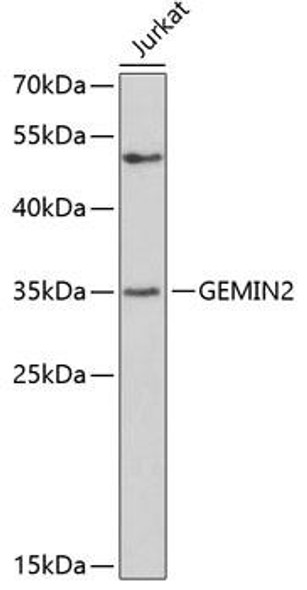 Epigenetics and Nuclear Signaling Antibodies 3 Anti-GEMIN2 Antibody CAB3082