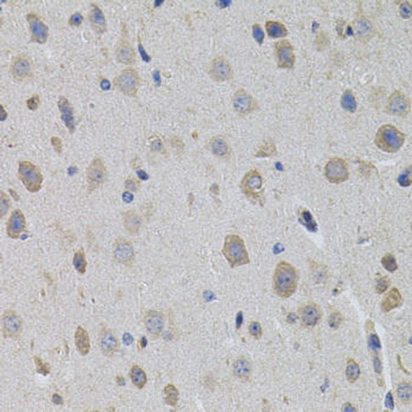 Signal Transduction Antibodies 2 Anti-SUMO3 Antibody CAB3099