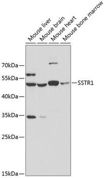 Cell Biology Antibodies 8 Anti-SSTR1 Antibody CAB3134