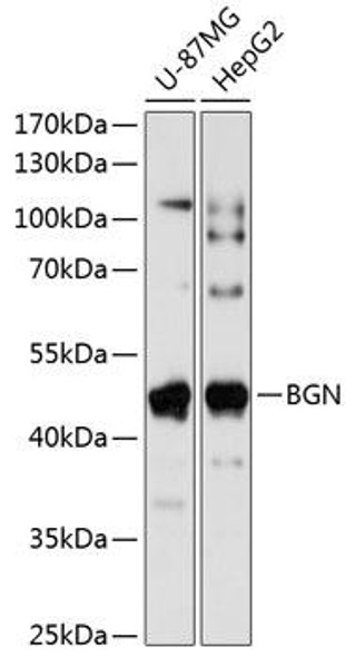 Cell Biology Antibodies 8 Anti-BGN Antibody CAB3137