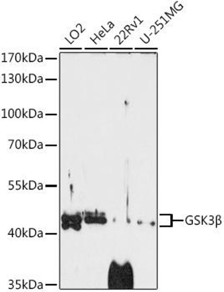 KO Validated Antibodies 1 Anti-GSK3Beta Antibody CAB3174KO Validated