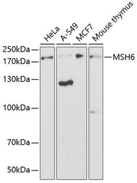 Epigenetics and Nuclear Signaling Antibodies 3 Anti-MSH6 Antibody CAB3177