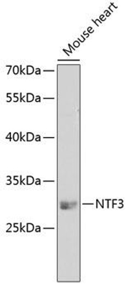 Cell Biology Antibodies 8 Anti-NTF3 Antibody CAB3179