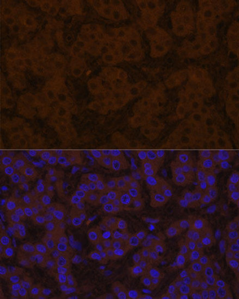 Signal Transduction Antibodies 2 Anti-TTR Antibody CAB3186