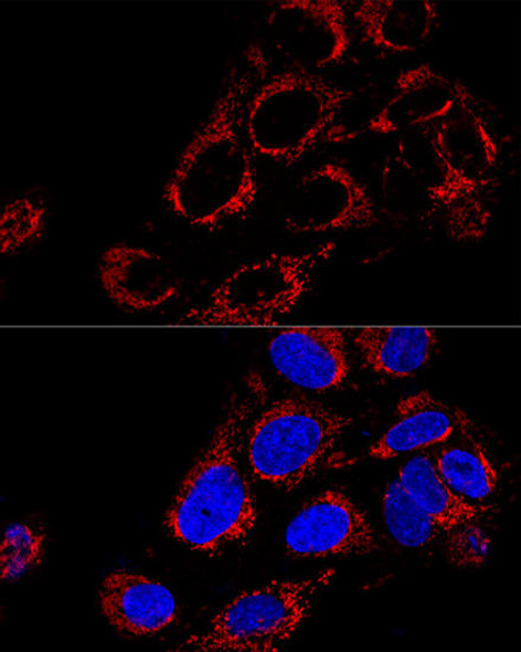 Signal Transduction Antibodies 2 Anti-TOMM40 Antibody CAB3213