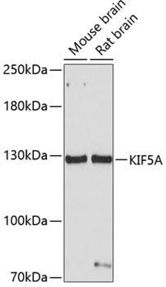 Cell Biology Antibodies 8 Anti-KIF5A Antibody CAB3303