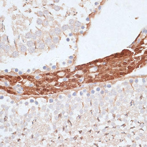 Cell Cycle Antibodies 1 Anti-KIFC1 Antibody CAB3304