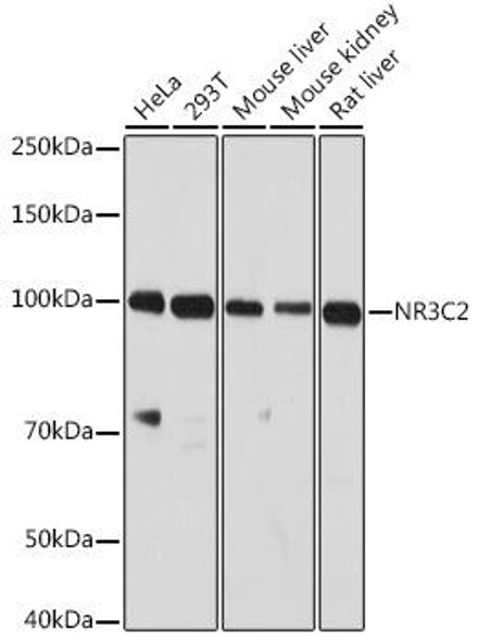 Epigenetics and Nuclear Signaling Antibodies 3 Anti-NR3C2 Antibody CAB3308