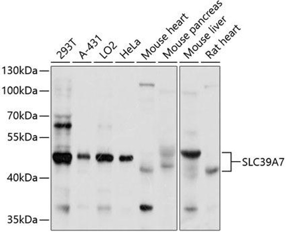Signal Transduction Antibodies 2 Anti-SLC39A7 Antibody CAB3343
