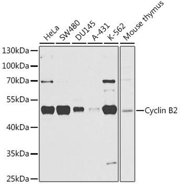 Cell Cycle Antibodies 1 Anti-Cyclin B2 Antibody CAB3351