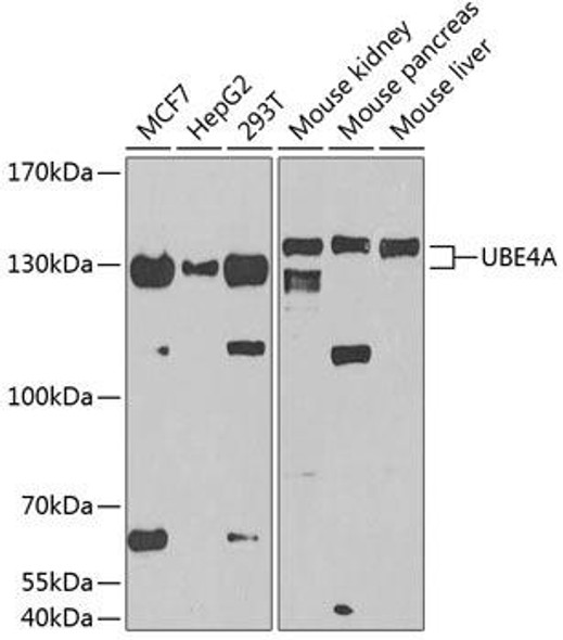 Signal Transduction Antibodies 2 Anti-UBE4A Antibody CAB3354