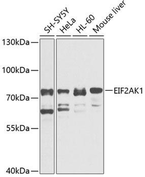 Cell Biology Antibodies 8 Anti-EIF2AK1 Antibody CAB3415