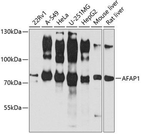 Cell Biology Antibodies 8 Anti-AFAP1 Antibody CAB3478