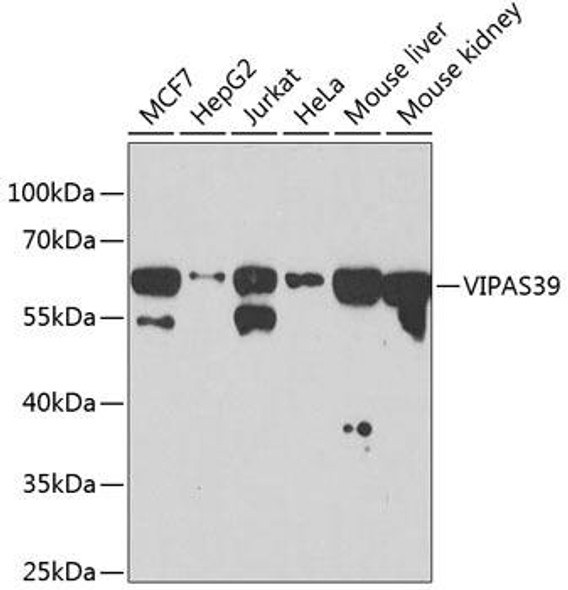 Developmental Biology Anti-VIPAS39 Antibody CAB3479