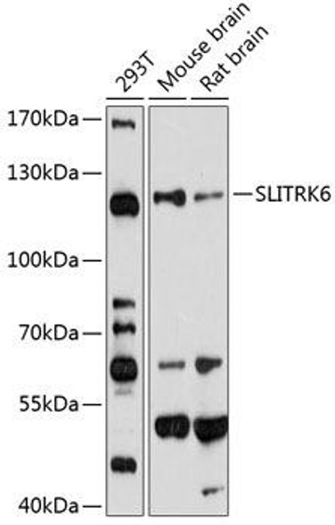 Cell Biology Antibodies 8 Anti-SLITRK6 Antibody CAB3521