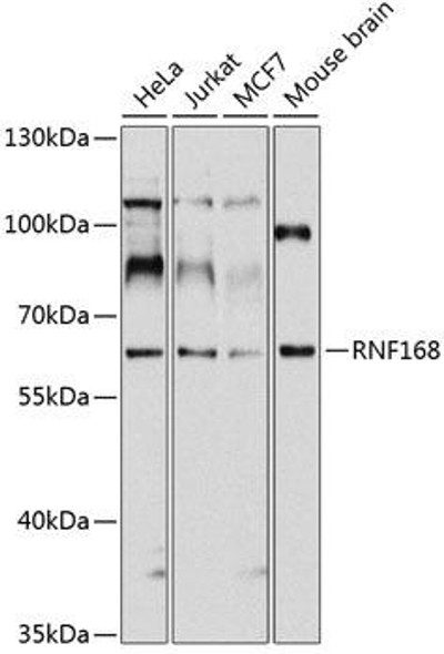 Epigenetics and Nuclear Signaling Antibodies 3 Anti-RNF168 Antibody CAB3556