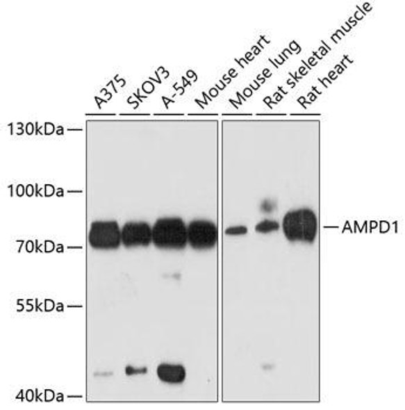 Metabolism Antibodies 2 Anti-AMPD1 Antibody CAB3584