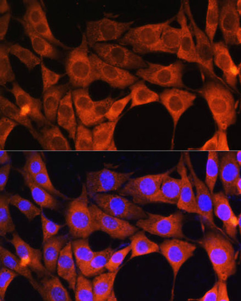 Cell Biology Antibodies 8 Anti-AOX1 Antibody CAB3586