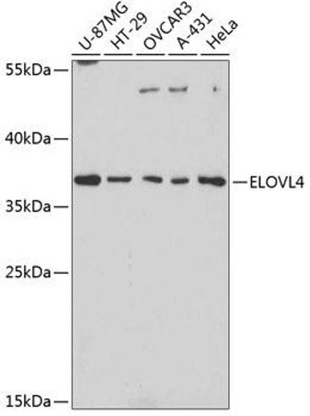 Metabolism Antibodies 2 Anti-ELOVL4 Antibody CAB3639