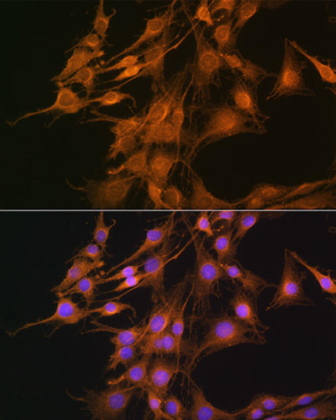 Metabolism Antibodies 2 Anti-ELOVL4 Antibody CAB3639