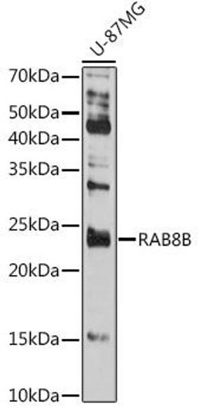 Cell Biology Antibodies 8 Anti-RAB8B Antibody CAB3678