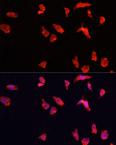 Signal Transduction Antibodies 2 Anti-ATP6V1B2 Antibody CAB3754