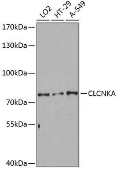 Signal Transduction Antibodies 2 Anti-CLCNKA Antibody CAB3792