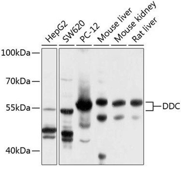 Metabolism Antibodies 2 Anti-DDC Antibody CAB3828