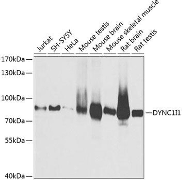 Signal Transduction Antibodies 2 Anti-DYNC1I1 Antibody CAB3833