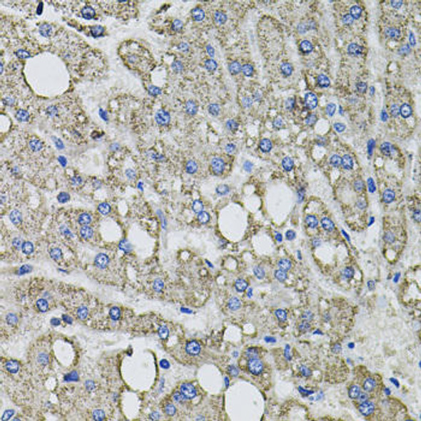 Cell Biology Antibodies 9 Anti-GFPT1 Antibody CAB3882