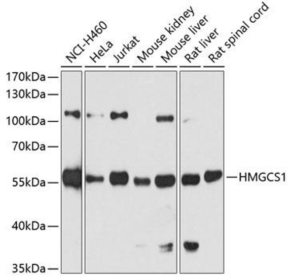 Metabolism Antibodies 2 Anti-HMGCS1 Antibody CAB3916